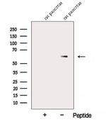 alpha Amylase 2B Antibody in Western Blot (WB)