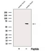 NAE1 Antibody in Western Blot (WB)