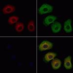 ARHGAP21 Antibody in Immunocytochemistry (ICC/IF)