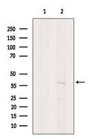 Aspartoacylase Antibody in Western Blot (WB)