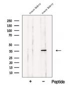 Aspartoacylase Antibody in Western Blot (WB)