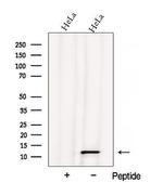 ATPIF1 Antibody in Western Blot (WB)