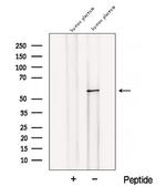 BANP Antibody in Western Blot (WB)