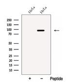 ATPGD1 Antibody in Western Blot (WB)