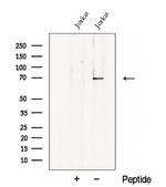 CHST15 Antibody in Western Blot (WB)