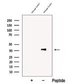 COQ5 Antibody in Western Blot (WB)