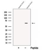 CPNE6 Antibody in Western Blot (WB)