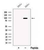 CSDE1 Antibody in Western Blot (WB)