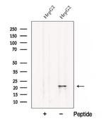 CRP2 Antibody in Western Blot (WB)