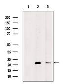 CRP2 Antibody in Western Blot (WB)