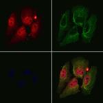 DDX17 Antibody in Immunocytochemistry (ICC/IF)