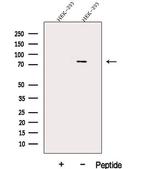 DDX17 Antibody in Western Blot (WB)