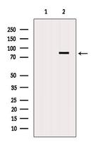 DDX17 Antibody in Western Blot (WB)