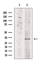 DIO2 Antibody in Western Blot (WB)