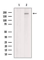 DOCK8 Antibody in Western Blot (WB)