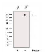 DOCK8 Antibody in Western Blot (WB)