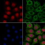 ECD Antibody in Immunocytochemistry (ICC/IF)