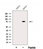 ECD Antibody in Western Blot (WB)