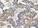 EXOC6 Antibody in Immunohistochemistry (Paraffin) (IHC (P))