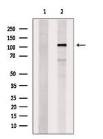 EXOC6 Antibody in Western Blot (WB)