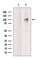 EXOC6 Antibody in Western Blot (WB)