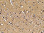 EXOSC10 Antibody in Immunohistochemistry (Paraffin) (IHC (P))