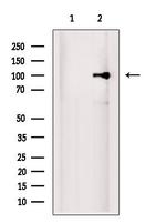 EXOSC10 Antibody in Western Blot (WB)