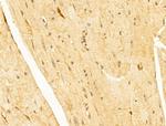 FBXW11 Antibody in Immunohistochemistry (Paraffin) (IHC (P))