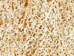 FBXW11 Antibody in Immunohistochemistry (Paraffin) (IHC (P))