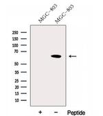 FBXW11 Antibody in Western Blot (WB)