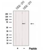 FBXW5 Antibody in Western Blot (WB)