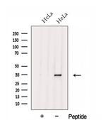 FGL1 Antibody in Western Blot (WB)