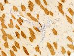 FOXRED1 Antibody in Immunohistochemistry (Paraffin) (IHC (P))