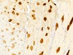 FOXRED1 Antibody in Immunohistochemistry (Paraffin) (IHC (P))