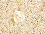 FOXRED1 Antibody in Immunohistochemistry (Paraffin) (IHC (P))