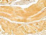 FKTN Antibody in Immunohistochemistry (Paraffin) (IHC (P))