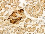 FKTN Antibody in Immunohistochemistry (Paraffin) (IHC (P))