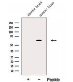 FKTN Antibody in Western Blot (WB)