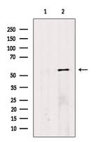 FKTN Antibody in Western Blot (WB)