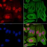 GCHFR Antibody in Immunocytochemistry (ICC/IF)