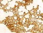 GCHFR Antibody in Immunohistochemistry (Paraffin) (IHC (P))