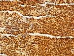 GINS3 Antibody in Immunohistochemistry (Paraffin) (IHC (P))