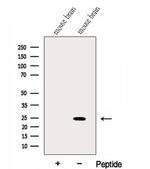 GLTP Antibody in Western Blot (WB)