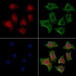 hnRNP R Antibody in Immunocytochemistry (ICC/IF)