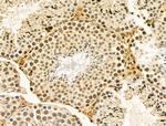 hnRNP R Antibody in Immunohistochemistry (Paraffin) (IHC (P))