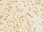 hnRNP R Antibody in Immunohistochemistry (Paraffin) (IHC (P))