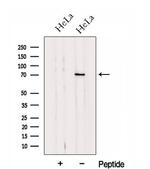 HP1BP3 Antibody in Western Blot (WB)