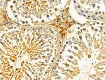 HSDL2 Antibody in Immunohistochemistry (Paraffin) (IHC (P))