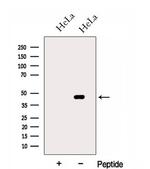 HSDL2 Antibody in Western Blot (WB)