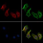 IFT122 Antibody in Immunocytochemistry (ICC/IF)